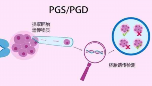 广州三代供卵试管生男孩费用解析，附详细价格明细！